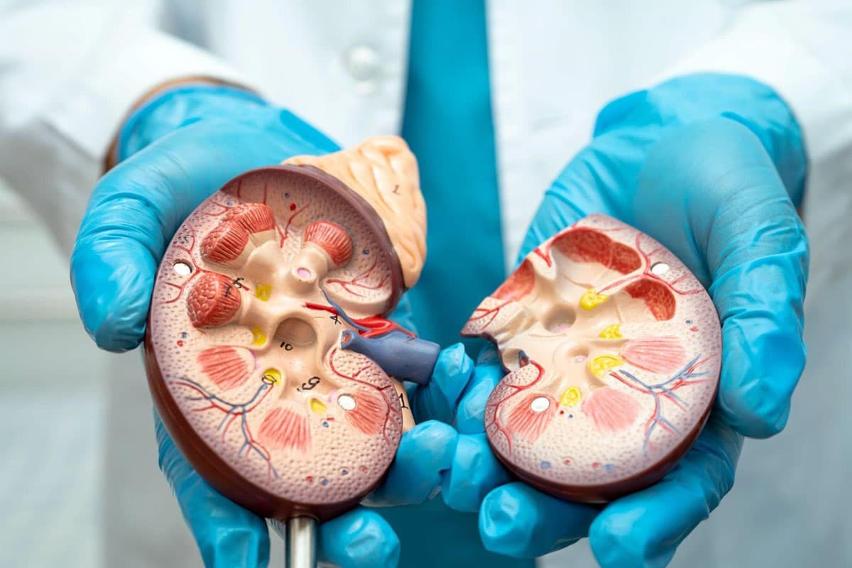 Mengenal TB Ginjal yang Diidap Lucky Element, Penyebab dan Pengobatannya